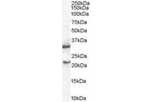 Image no. 1 for anti-Suppressor of Cytokine Signaling 1 (SOCS1) (C-Term) antibody (ABIN374072) (SOCS1 antibody  (C-Term))