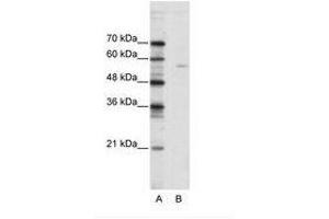 Image no. 1 for anti-ELK1, Member of ETS Oncogene Family (ELK1) (N-Term) antibody (ABIN202499) (ELK1 antibody  (N-Term))