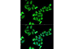 Immunofluorescence analysis of A549 cells using GALE antibody. (GALE antibody  (AA 129-348))