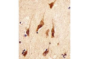 (ABIN6242191 and ABIN6578387) staining ARRB2 in human brain tissue sections by Immunohistochemistry (IHC-P - paraformaldehyde-fixed, paraffin-embedded sections). (Arrestin 3 antibody  (AA 264-298))