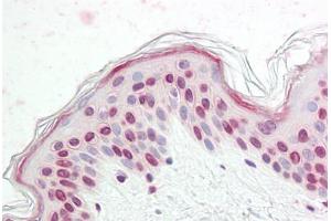 NK2 Homeobox 4 antibody  (Internal Region)