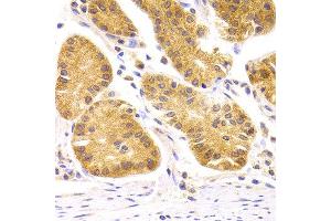 Immunohistochemistry of paraffin-embedded Human gastric using SCO2 antibody at dilution of 1:100 (x400 lens).