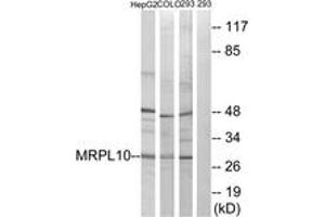 Western blot analysis of extracts from 293/HepG2/COLO cells, using MRPL10 Antibody. (MRPL10 antibody  (AA 211-260))