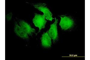 Immunofluorescence of monoclonal antibody to NOTCH2NL on HeLa cell. (NOTCH2NL antibody  (AA 1-236))