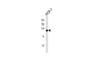 Lane 1: MCF-7 Cell lysates, probed with MGMT (888CT22. (MGMT antibody)