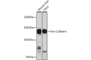Western blot analysis of extracts of various cell lines, using Pan Cadherin Rabbit mAb (ABIN1679719, ABIN3019268, ABIN3019269 and ABIN7101741) at 1:1000 dilution.