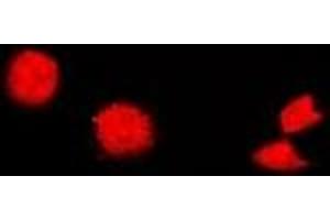 Immunofluorescent analysis of Cholinesterase staining in U2OS cells. (Butyrylcholinesterase antibody)
