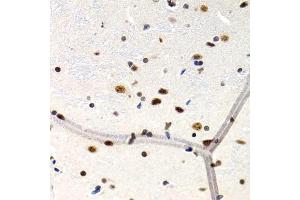 Immunohistochemistry of paraffin-embedded rat brain using MT2A antibody (ABIN1873764) at dilution of 1:200 (40x lens). (MT2A antibody)