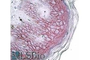 AP31715PU-N DSG1 antibody staining of paraffin embedded Human skin at 3. (Desmoglein 1 antibody  (Internal Region))