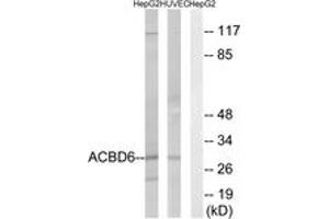 Western blot analysis of extracts from HepG2/HuvEc cells, using ACBD6 Antibody.