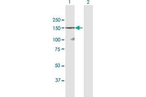 Western Blot analysis of DSG1 expression in transfected 293T cell line by DSG1 MaxPab polyclonal antibody.