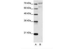 Image no. 1 for anti-Apoptosis Antagonizing Transcription Factor (AATF) (N-Term) antibody (ABIN202765) (AATF antibody  (N-Term))