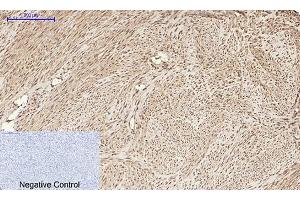 Immunohistochemical analysis of paraffin-embedded human uterus tissue. (HMGB1 antibody  (N-Term))