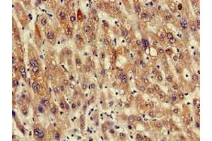 Immunohistochemistry of paraffin-embedded human liver tissue using ABIN7167597 at dilution of 1:100 (RGS19 antibody  (AA 1-87))