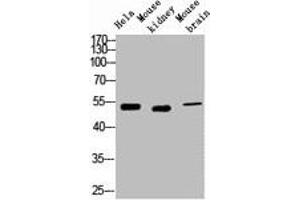 Western blot analysis of 1) Hela, 2) Mouse Kidney, 3) Mouse Brain, diluted at 1:2000. (Cytokeratin 7 antibody)