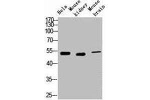 Western blot analysis of 1) Hela, 2) Mouse Kidney, 3) Mouse Brain, diluted at 1:2000. (Cytokeratin 7 antibody)