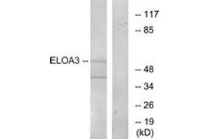 Western blot analysis of extracts from COLO205 cells, using ELOA3 Antibody. (TCEB3C antibody  (AA 381-430))