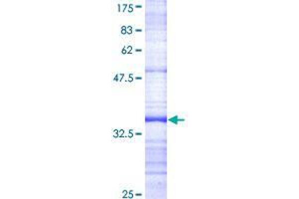 BFAR Protein (AA 101-200) (GST tag)