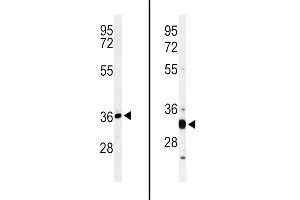 Western blot analysis of ST8SIA4 Antibody (Center) (ABIN653728 and ABIN2843035) in HL-60 cell line lysates (35 μg/lane). (ST8SIA4 antibody  (AA 186-214))