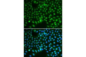 Immunofluorescence (IF) image for anti-Discs, Large (Drosophila) Homolog-Associated Protein 5 (DLGAP5) (AA 547-846) antibody (ABIN3023190) (DLGAP5 antibody  (AA 547-846))