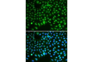 Immunofluorescence (IF) image for anti-Discs, Large (Drosophila) Homolog-Associated Protein 5 (DLGAP5) (AA 547-846) antibody (ABIN3023190) (DLGAP5 antibody  (AA 547-846))