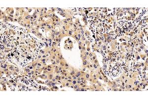 Immunohistochemistry (IHC) image for anti-Interleukin 2 Receptor, alpha (IL2RA) (AA 22-213) antibody (ABIN7434179)