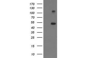 HEK293T cells were transfected with the pCMV6-ENTRY control (Left lane) or pCMV6-ENTRY TUBB4 (Right lane) cDNA for 48 hrs and lysed. (TUBB4 antibody)