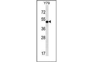 Western blot analysis of HOXA13 / HOX1J Antibody (C-term) in Y79 cell line lysates (35ug/lane).