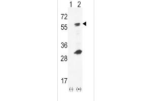 Western blot analysis of GCK (arrow) using rabbit polyclonal hGCK- (ABIN392391 and ABIN2842019). (GCK antibody  (C-Term))