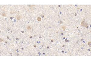Detection of Bid in Human Cerebrum Tissue using Polyclonal Antibody to BH3 Interacting Domain Death Agonist (Bid) (BID antibody  (AA 1-195))