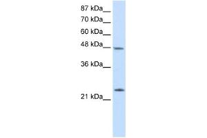 Western Blot showing CBX6 antibody used at a concentration of 1-2 ug/ml to detect its target protein.