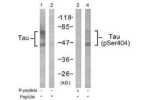 Image no. 1 for anti-Microtubule-Associated Protein tau (MAPT) (Ser404) antibody (ABIN197270) (MAPT antibody  (Ser404))