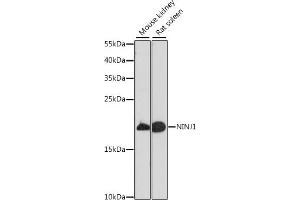 Western blot analysis of extracts of various cell lines, using NINJ1 antibody (ABIN7268918) at 1:1000 dilution. (NINJ1 antibody  (AA 1-100))