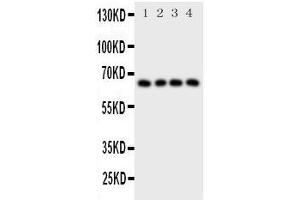 Western Blotting (WB) image for anti-Parathyroid Hormone 1 Receptor (PTH1R) (AA 388-406), (C-Term) antibody (ABIN3043983) (PTH1R antibody  (C-Term))
