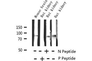 Western blot analysis of Phospho-Tau (Ser214) expression in various lysates (MAPT antibody  (pSer214))