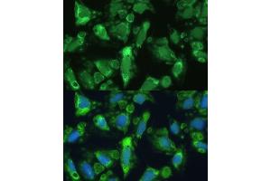 Immunofluorescence analysis of U-2 OS cells using ENO1 antibody (ABIN3021299, ABIN3021300, ABIN3021301, ABIN1512865 and ABIN6214545) at dilution of 1:100. (ENO1 antibody  (AA 1-434))