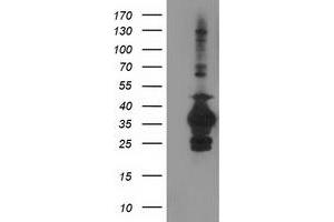 HEK293T cells were transfected with the pCMV6-ENTRY control (Left lane) or pCMV6-ENTRY SULT1C2 (Right lane) cDNA for 48 hrs and lysed. (SULT1C2 antibody)