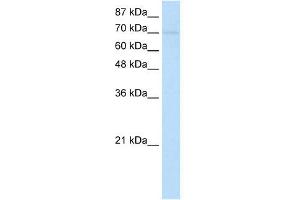 WB Suggested Anti-ZNF282 Antibody Titration:  1. (ZNF282 antibody  (N-Term))