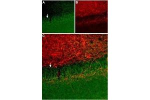 Expression of SSTR2 in rat hippocampus - Immunohistochemical staining of rat hippocampus using Anti-Somatostatin Receptor Type 2 (extracellular) Antibody (ABIN7043765, ABIN7045268 and ABIN7045269). (SSTR2 antibody  (Extracellular, N-Term))