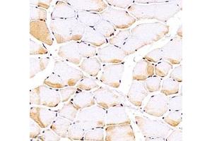 Immunohistochemistry of paraffin embedded rat Skeletal muscle using Troponin I f(ABIN7076031) at dilution of 1:700 (400x lens) (TNNI2 antibody)