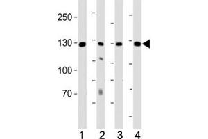 Western blot analysis of lysate from (1) K562 cell line, (2) human lung, (3) mouse kidney and (4) mouse heart tissue using ROR1 antibody at 1:1000. (ROR1 antibody)