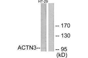 Western Blotting (WB) image for anti-Actinin, alpha 3 (ACTN3) (N-Term) antibody (ABIN1850168)