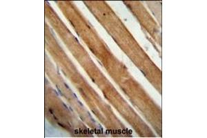 SLC25A12 antibody (N-Term) (ABIN654231 and ABIN2844065) immunohistochemistry analysis in formalin fixed and paraffin embedded human skeletal muscle followed by peroxidase conjugation of the secondary antibody and DAB staining. (SLC25A12 antibody  (N-Term))