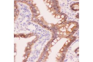 Anti-CTNNA1 Picoband antibody,  IHC(P): Rat Intestine Tissue (CTNNA1 antibody  (AA 143-292))