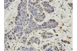 Immunohistochemistry (IHC) image for anti-Proteasome (Prosome, Macropain) 26S Subunit, Non-ATPase, 7 (PSMD7) antibody (ABIN1876544) (PSMD7 antibody)