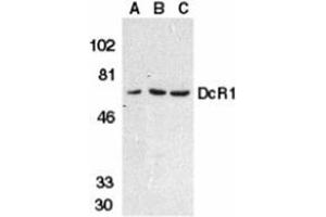 Western blot analysis of DcR1 in HeLa cell (A), mouse (B) and rat (C) liver tissue lysates with AP30279PU-N DcR1 antibody at 1 μg/ml. (DcR1 antibody)