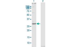 Western Blot analysis of STOM expression in transfected 293T cell line by STOM MaxPab polyclonal antibody. (Stomatin antibody  (AA 1-288))