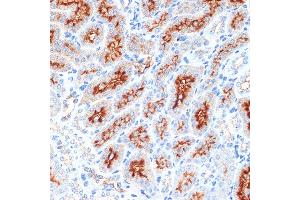 Immunohistochemistry of paraffin-embedded mouse kidney using Syntaxin 3 Rabbit mAb (ABIN7270686) at dilution of 1:100 (40x lens). (STX3 antibody)