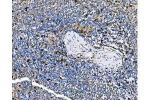 IHC analysis of PAK1 using anti-PAK1 antibody (ABIN7599852).