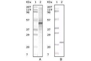Western Blot showing Apoa5 antibody used against human serum (A) and Apoa5 recombinant protein (B). (APOA5 antibody)